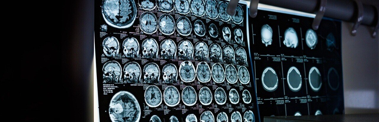 working memory